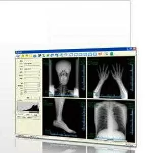 Цифровой приемник рентгенграфического изображения,  новый, Япония